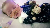 Nasib Bayi Charlie yang Idap Penyakit Langka Ini Masih Tak Pasti