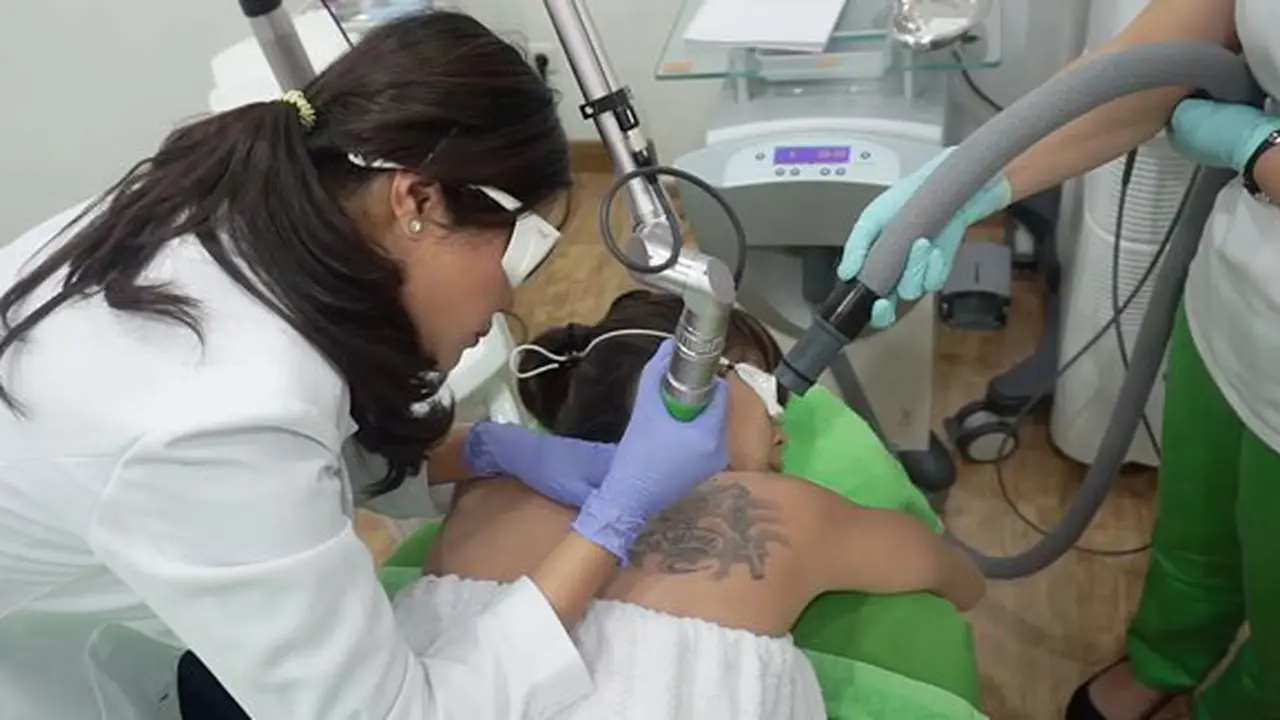 Proses tattoo removal di ZAP Clinic/Foto: copyright ZAP Clinic