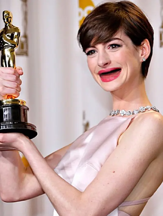 Senyuman Aktris cantik Anne Hathaway ketika menerima piala Oscar. Artis ini telah membintangi beberapa film layar lebar diantaranya film Batman The Dark Knight Rises. (Instagram@actresseswithoutteeth)