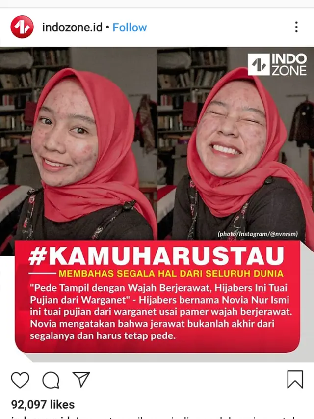 Percaya Diri Unggah Foto Berjawat di Medsos, Perempuan Ini Viral dan Menginspirasi