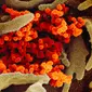 Gambar menggunakan mikroskop elektron yang tak bertanggal pada Februari 2020 menunjukkan virus corona SARS-CoV-2 (oranye) muncul dari permukaan sel (hijau) yang dikultur di laboratorium.  Sampel virus dan sel diambil dari seorang pasien yang terinfeksi COVID-19. (NIAID-RML via AP)