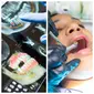 Jalani pemeriksaan gigi dengan dosis anastesi yang berlebihan dan prosedur berulang, wanita ini kemudian menuntut dokter gigi yang menanganinya. Sumber: Photo: Quang Tri NGUYEN & lafayett zapata montero/Unsplash