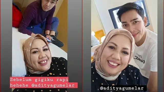 Beda Gaya Ely Sugigi Sebelum Vs Sesudah Potong Gigi (sumber: instagram/ellysugigi_real_)