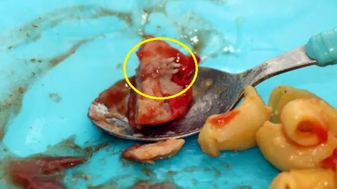 Waspada, Kelar Bakso Tikus Ternyata Ada Kasus Sosis Tikus!