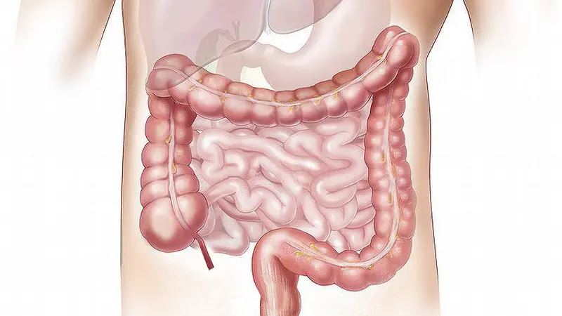 5 Fungsi Usus Halus pada Manusia, Bantu Penyerapan Nutrisi dan Penetral Makanan