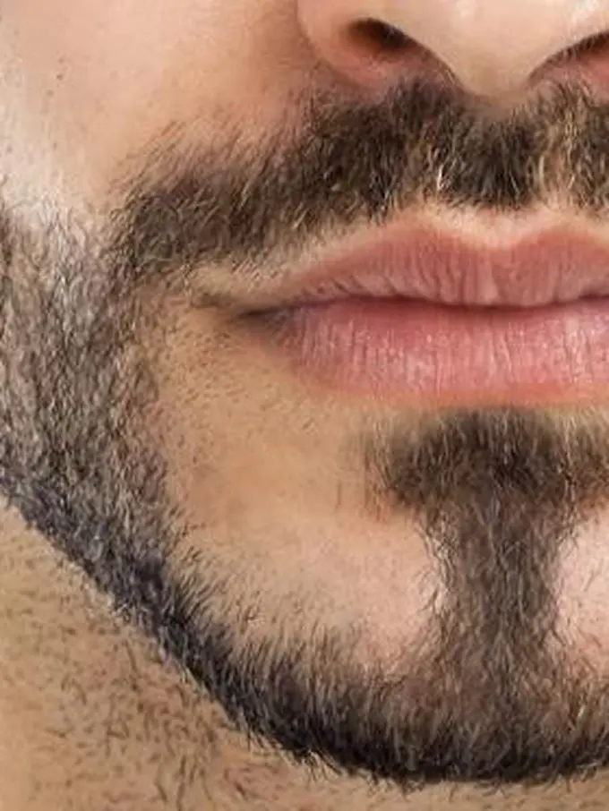 [Bintang] Ilustrasi Kumis