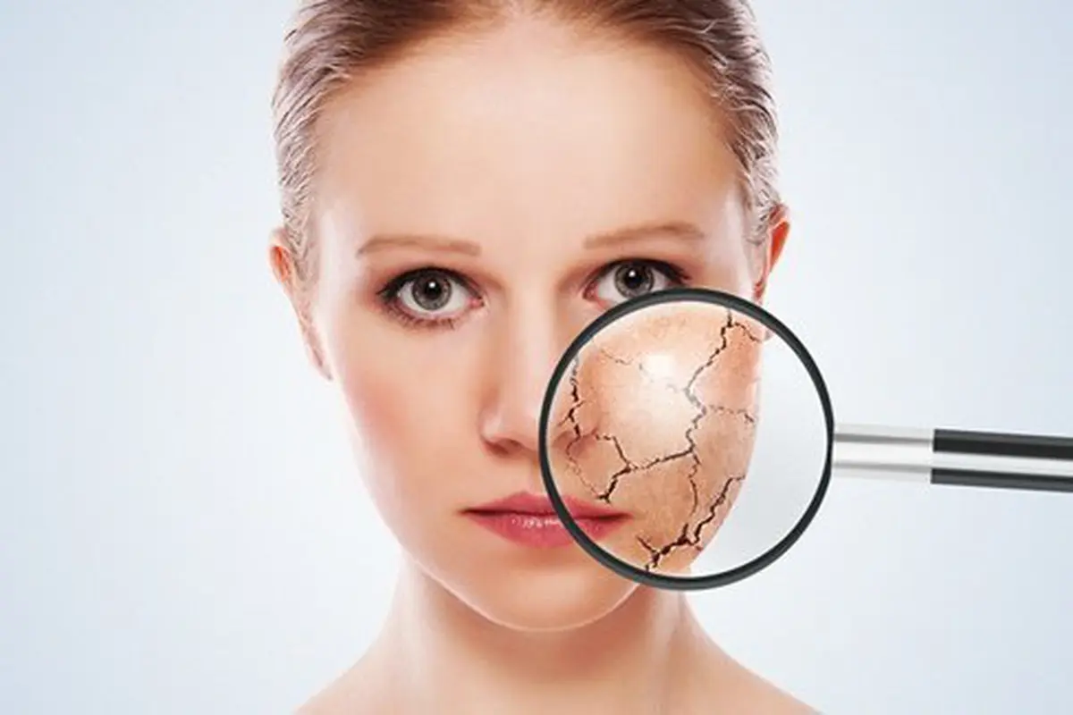 Kulit kering akan membuat wajah tampak kusam/copyright: thinkstockphotos.com