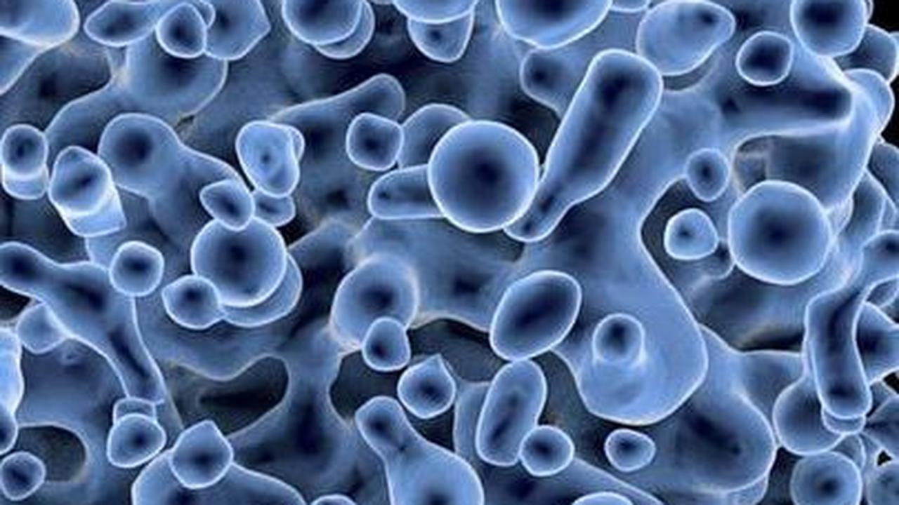 Bagaimana HIV Bisa Menular?