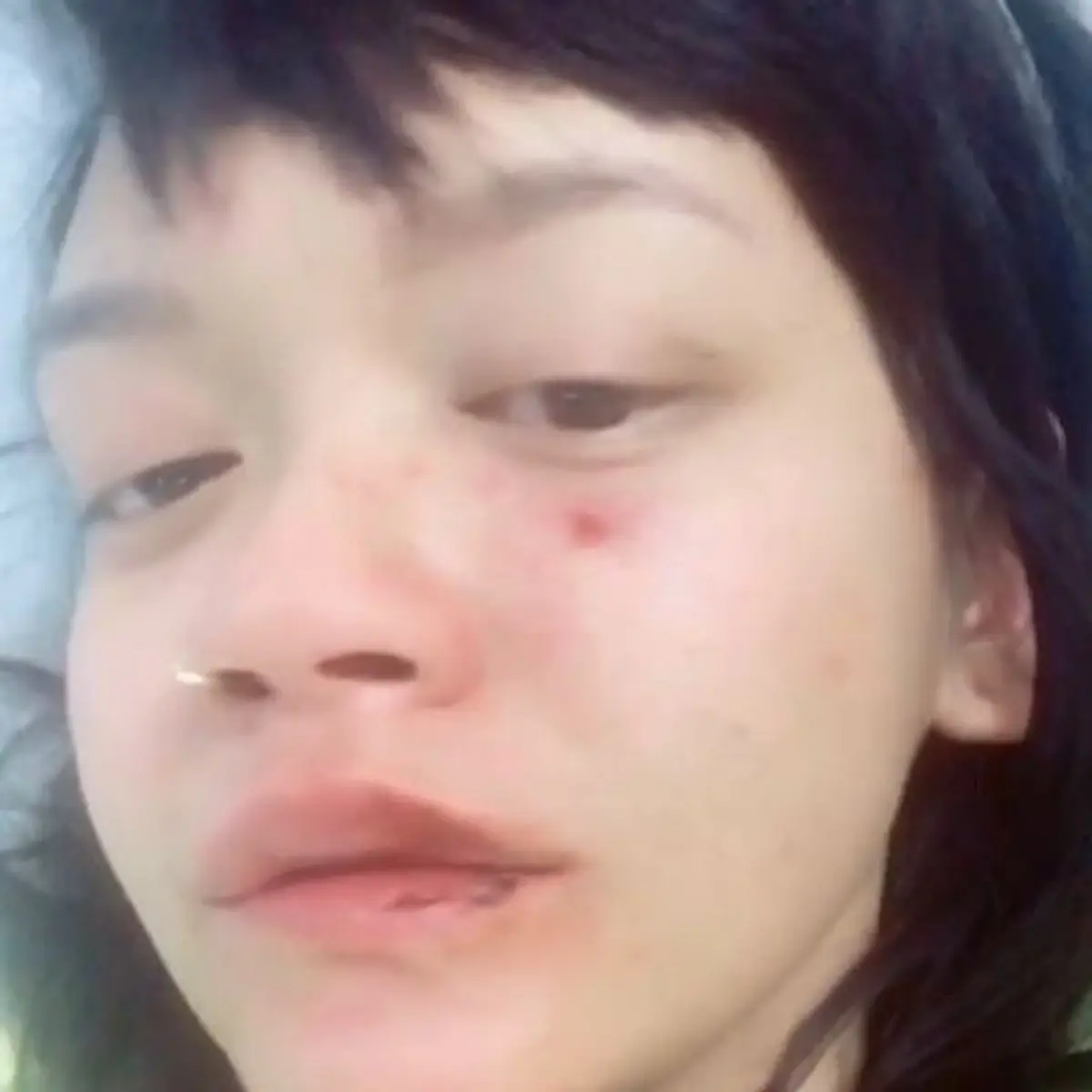 Dibuat Babak Belur, Dylan Sada: Saya Maafkan Dia - Lifestyle Fimela.com