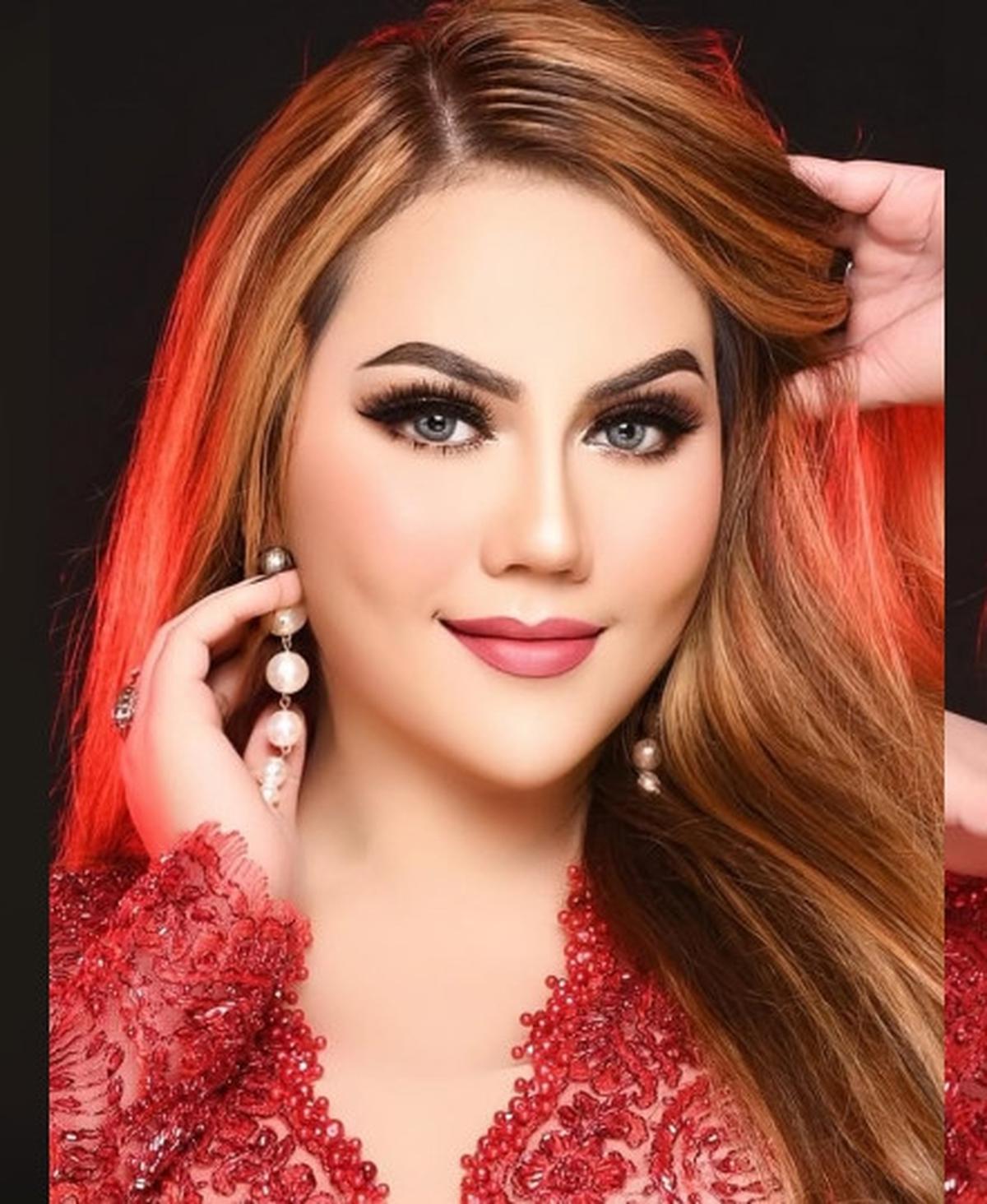Kini Sudah Sembuh Total, Nita Thalia Ternyata Pernah Sakit Gangguan Syaraf Otak Sampai Berobat ke Singapura