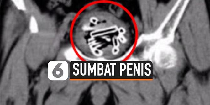 VIDEO: Pria ini Sumbat Penisnya dengan 47 Tabung Plastik