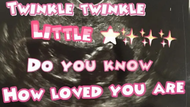 [Bintang] Andi Soraya