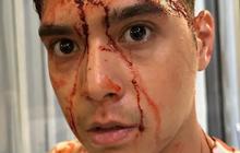 Al Ghazali Tiba-tiba Unggah Foto Bercucuran 'Darah', Kenapa?