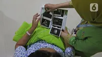Begini SOP Pemeriksaan Kehamilan yang Benar dan Beretika agar Perempuan Tak Jadi Korban Oknum Dokter Cabul