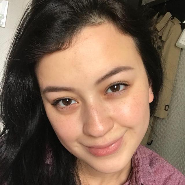 6 Artis Ini Tetap Memesona Saat Pamer Freckles, Banjir Pujian