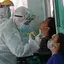 Diagnosis Covid-19 dapat ditegakkan berdasarkan pemeriksaan adanya virus SARS-CoV-2 di dalam tubuh pasien.