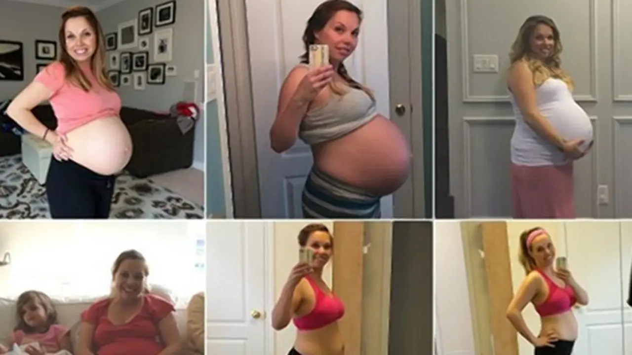 Tak Langsung Kurus Usai Melahirkan, Wanita Ini Bagi Kisahnya