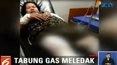 Hampir seluruhnya mengalami luka bakar serius, mulai dari 40 persen hingga hampir 100 persen.