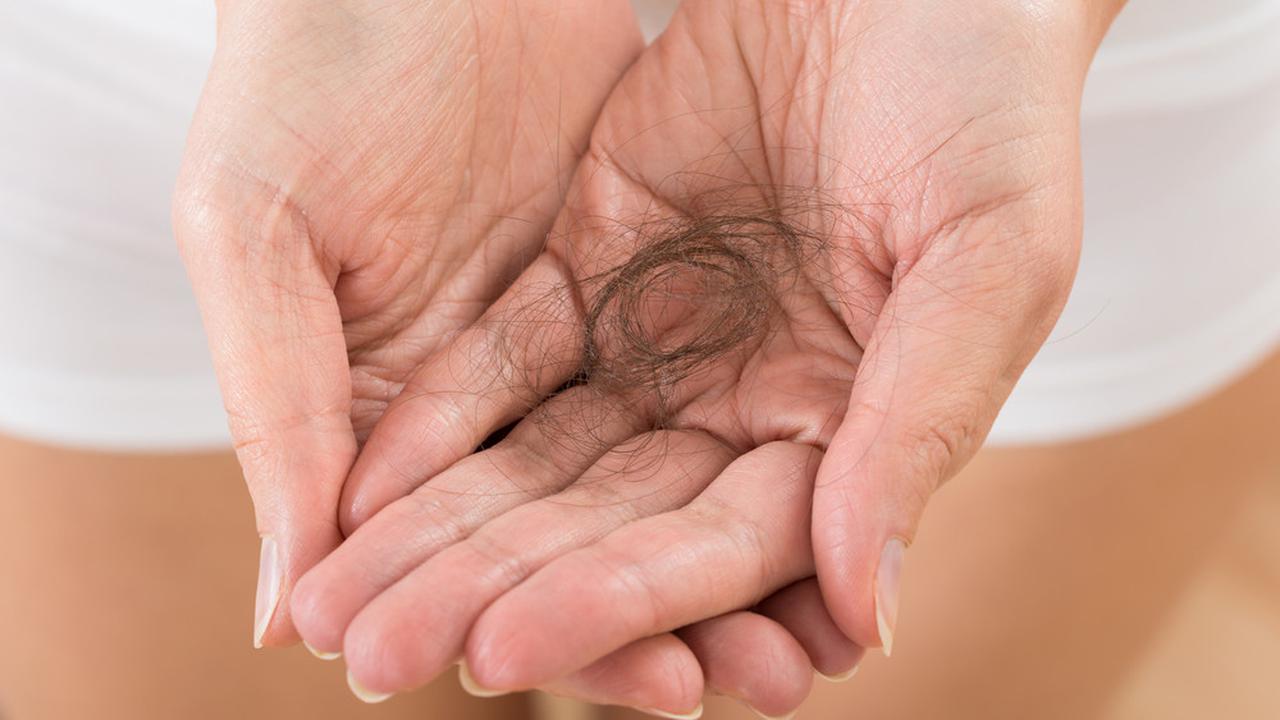 Ilustrasi rambut rontok