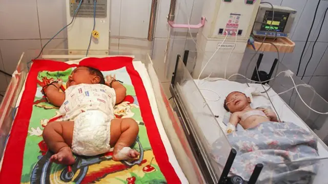 Seorang Ibu di India Lahirkan Bayi Seberat Hampir 6 Kg