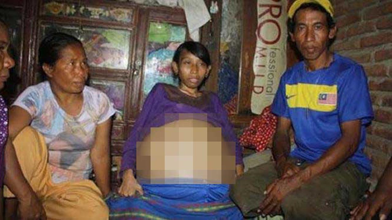 Tak Mampu Biayai Operasi Tumor, Kamarni Hanya Bisa Terbaring