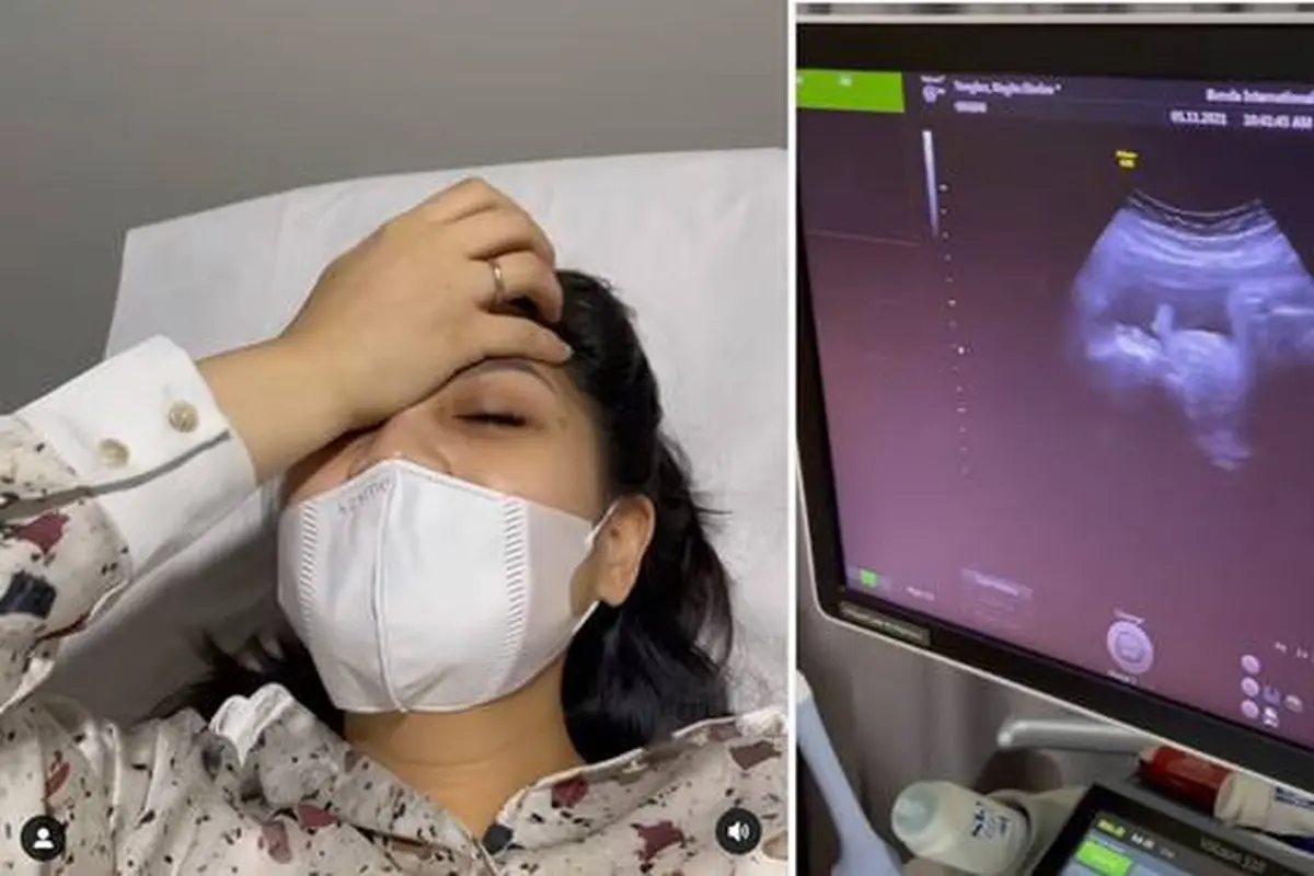 Nagita Slavina Melahirkan Bulan November, Ini 7 Momen USG yang Perlihatkan Buah Hati