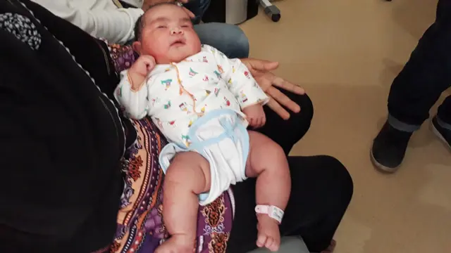Bayi raksasa berjenis kelamin perempuan berbobot 5,8 kilogram. (Foto: Liputan6.com/Muhamad Ridlo)