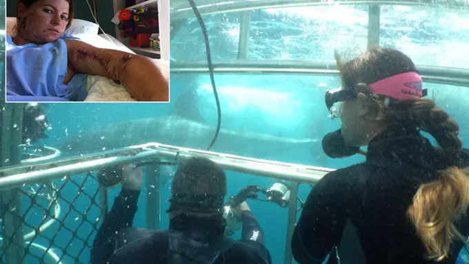 Hampir Tewas, Seekor Hiu Putih Koyakkan Lengan Perempuan Ini