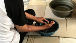 Pasien kusta sedang merendam tangan dengan air hangat. Foto: Liputan6.com/Ade Nasihudin.