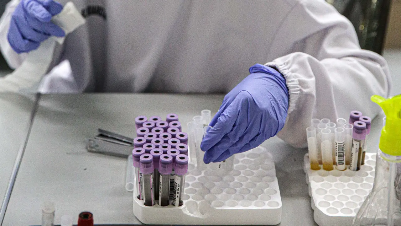 PMI DKI Jakarta Ajak Penyintas COVID-19 Donor Plasma Konvalesen