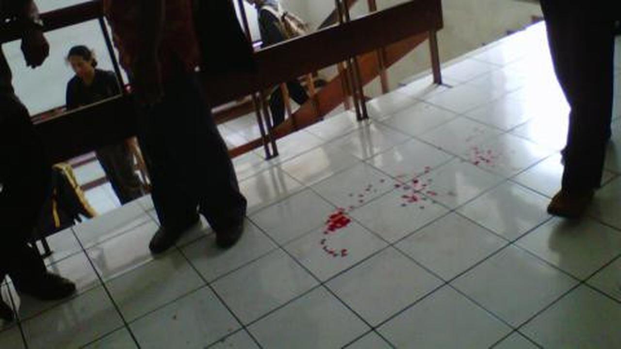 Mata Sistoyo bengkak, pengacara ajukan surat ke KPK