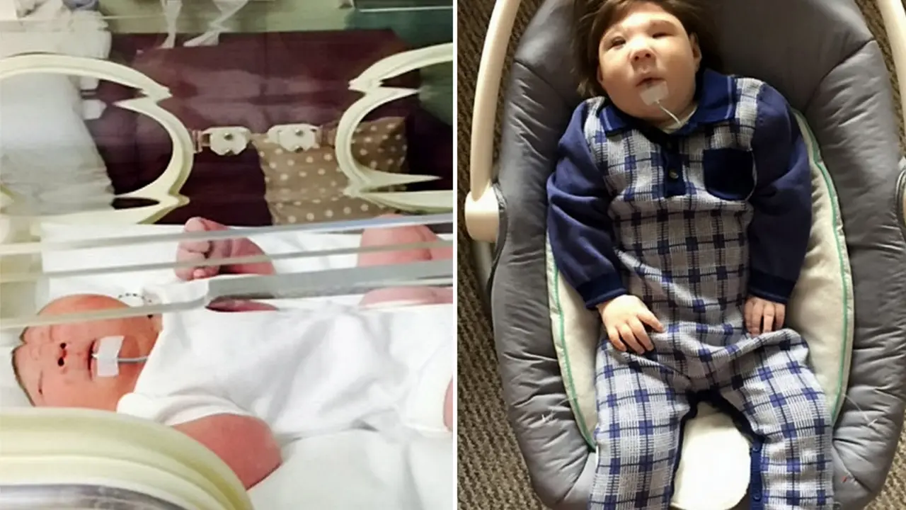 Harapan Hidup 3 Persen, Bayi Ini Berhasil Lalui Tahun Pertamanya 
