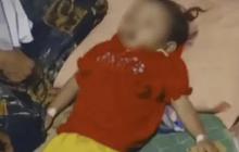 Ini Tanggapan Bupati Sukabumi soal Raya Meninggal Akibat Tubuh & Otaknya Dipenuhi Cacing