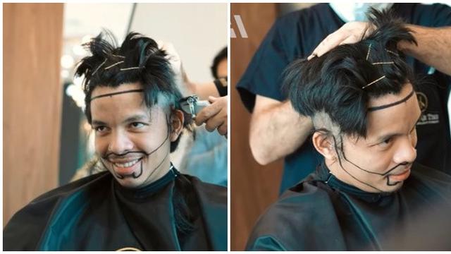 6 Artis yang Pernah Transplantasi Rambut, Terbaru Atta Halilintar