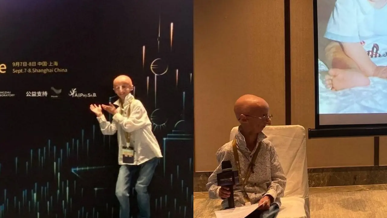 Meski menderita progeria sejak kecil, Sammy Basso menunjukkan semangat luar biasa. Dedikasinya dalam penelitian memberi harapan bagi banyak orang yang terkena penyakit ini. (Foto: instagram.com/sammybasso)