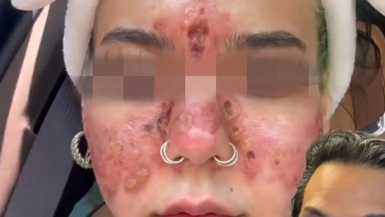 Kasus Skincare Kedaluwarsa