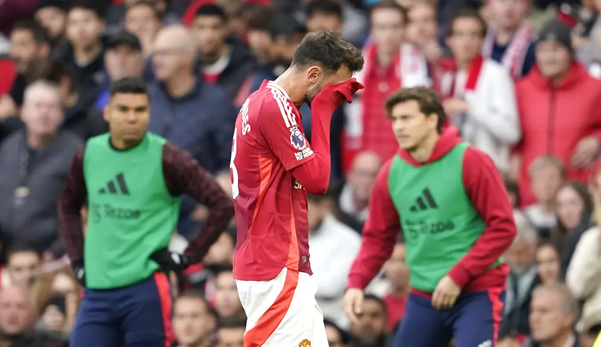 Alhasil gelandang asal Portugal tersebut harus meninggalkan lapangan dan membuat timnya bermain dengan 10 orang sejak saat itu. (AP Photo/Dave Thompson)