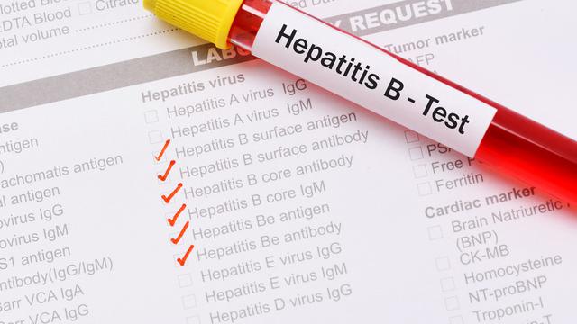 Gejala Penyakit Hepatitis B yang Perlu Diketahui dan Cara Pencegahannya