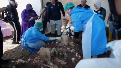Dokter Ungkap Penyebab Busa di Mulut Jenazah Sutrimo