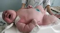Seorang perempuan yang memiliki bobot tubuh 272 kilogram baru-baru ini telah melahirkan bayinya dengan berat 18 kilogram.