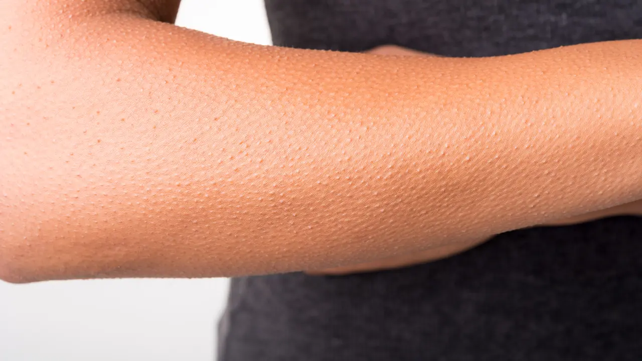 8 Macam-macam Penyakit Kulit Yang Berbahaya dan Biasa Menyerang Orang