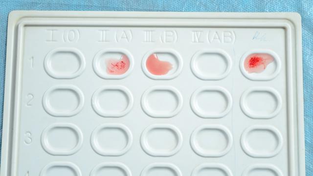 Golongan darah (iStockphoto)