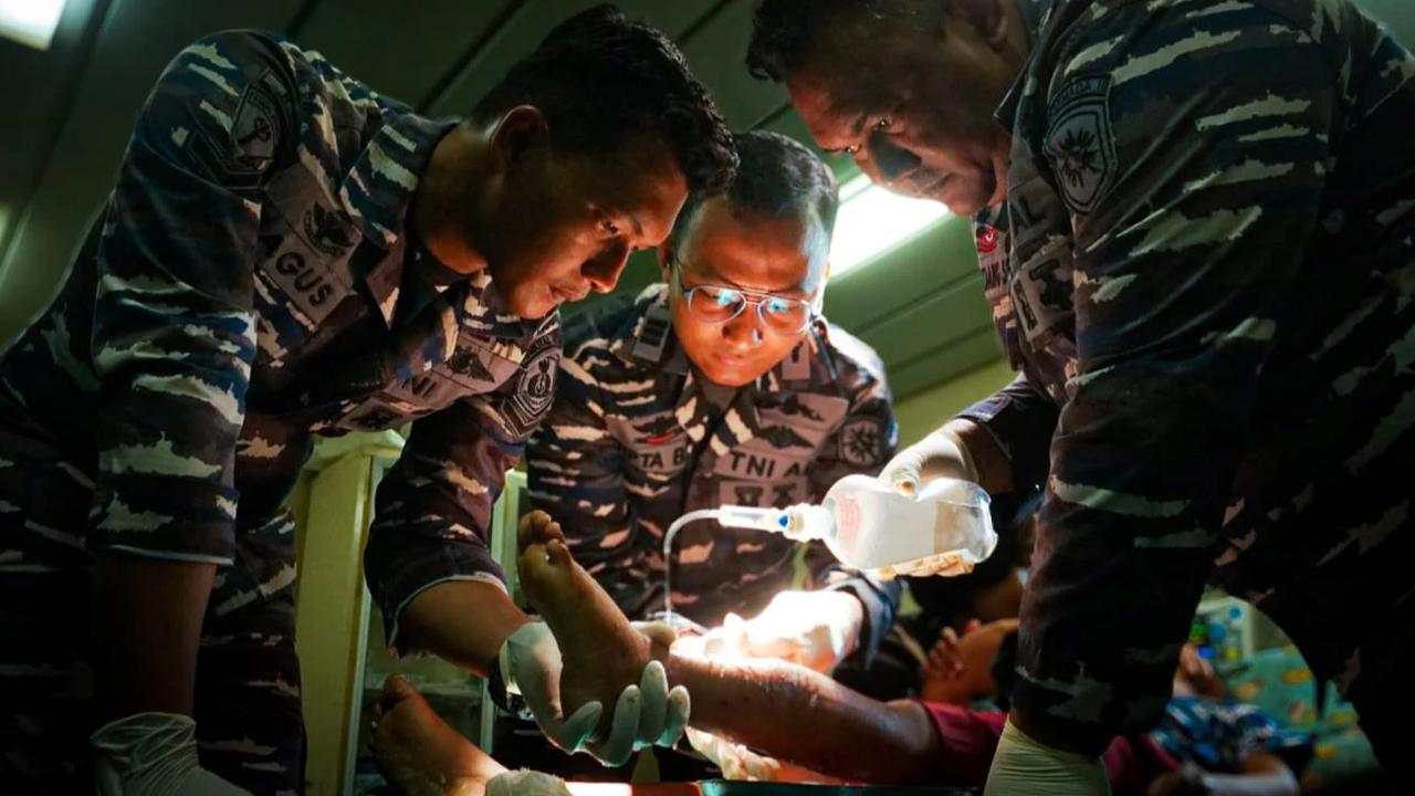 FOTO: Kondisi Pasien Anak Korban Bencana Sumatra Pascaoperasi di KRI dr Soeharso