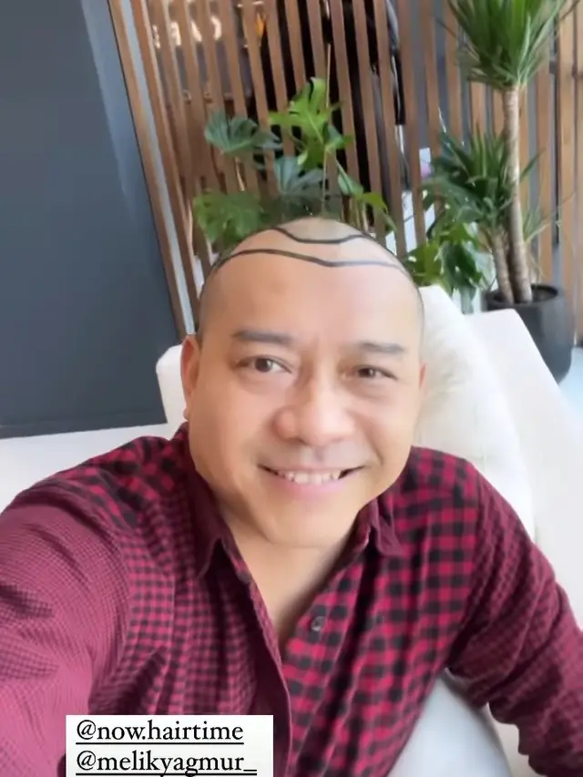 Anang Hermansyah