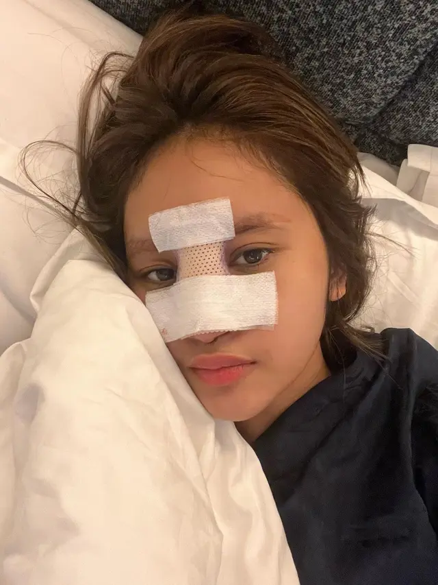 12 Foto Kronologi Dhyaz Anak Farida Nurhan Alami Infeksi Hidung hingga Angkat Implan