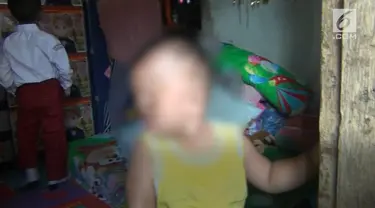 Seorang bayi terlahir cacat di wajah dan butuh perhatian pemerintah. Kondisi ini diperparah dengan sang bayi yang hanya punya satu ginjal saja.