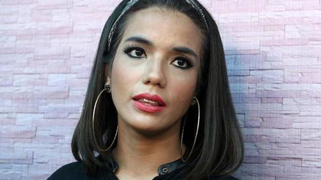 Alami Kecelakaan, Sheila Marcia Akan Menjalani Operasi