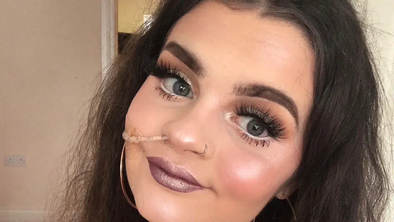 [Fimela] Kisah beauty vlogger yang harus menggunakan selang makanan seumur hidup