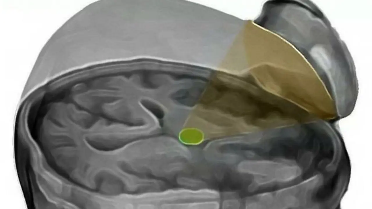 pioneering ultrasound. Foto: Mirror