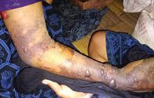 Serangan Ular Jenis Ini Gigit 28 Warga Badui, 2 Orang Meninggal